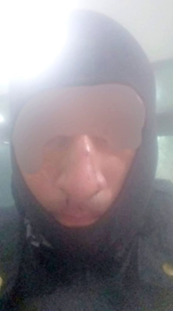 El sargento recibió un golpe en su nariz