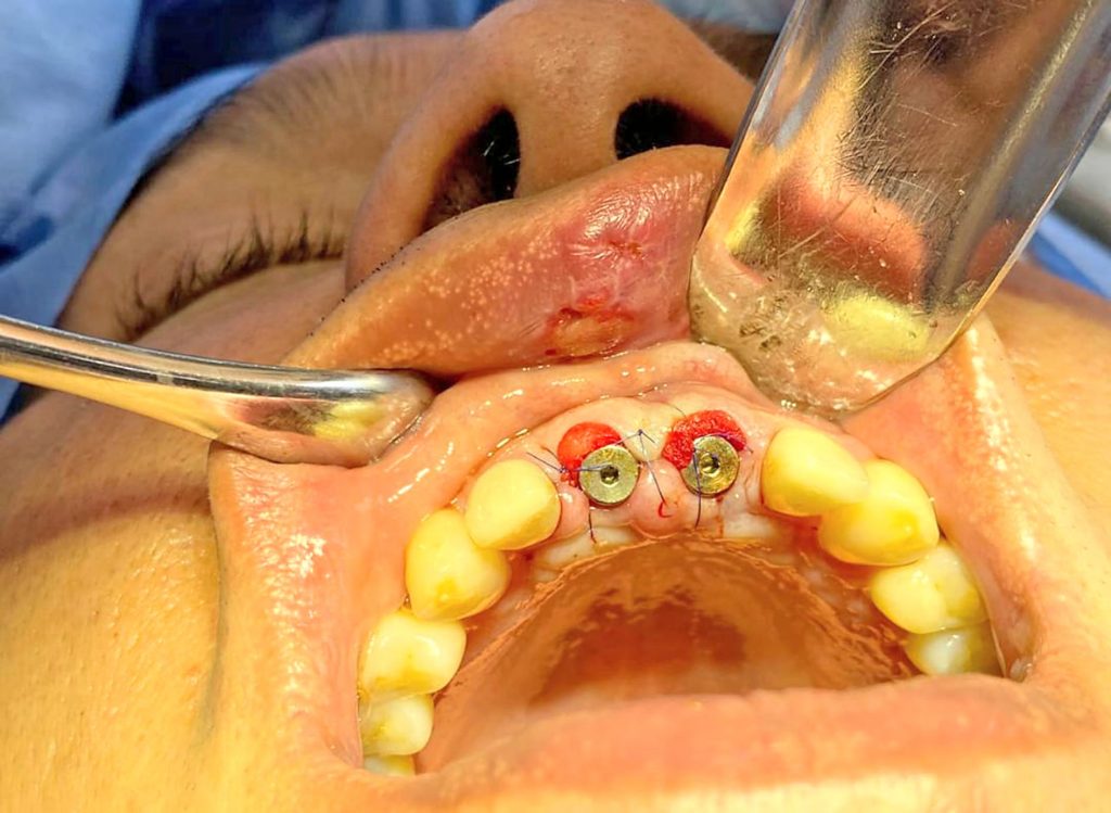 Así quedó Marco R. V. tras recibir el puntapié.