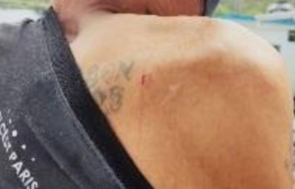 La herida que Freddy G. G. recibió no es de consideración.