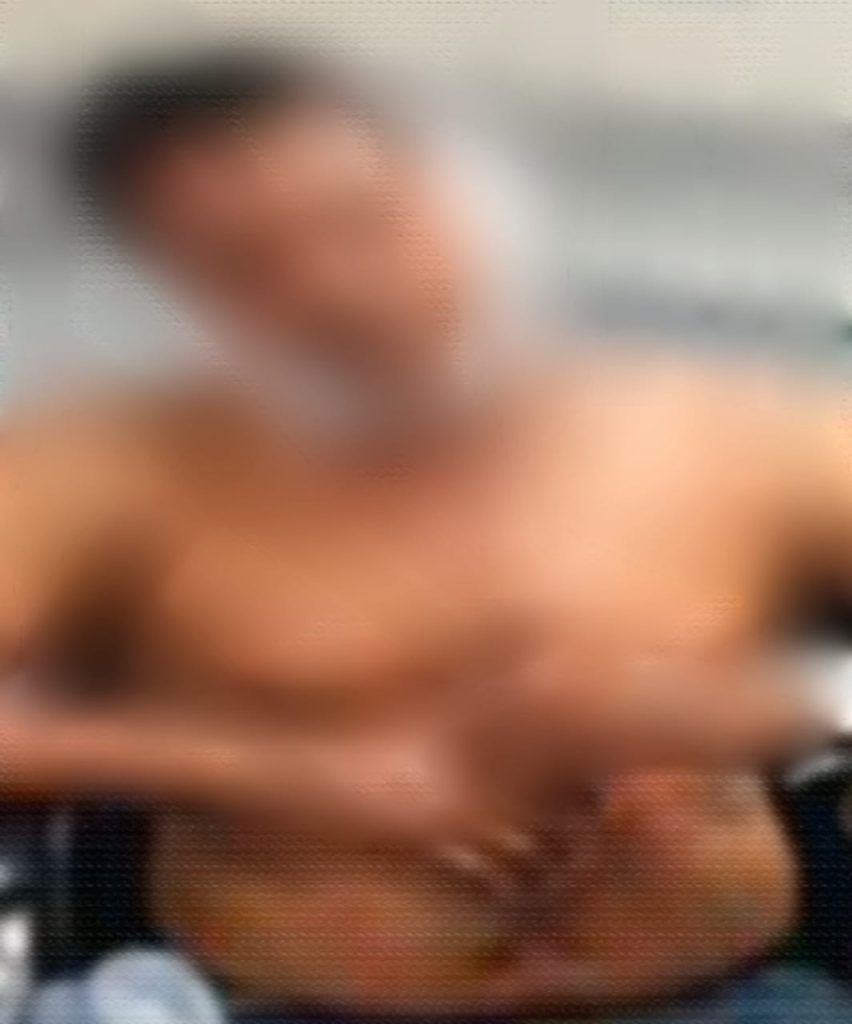 El ciudadano fue atendido en el Centro de Salud, del barrio Trapichillo.