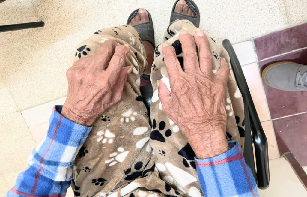 El adulto mayor perdió la movilidad de sus manos.