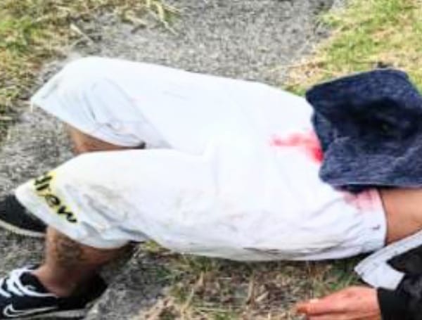 El ciudadano fue operado, la tarde de ayer, y está fuera de peligro.