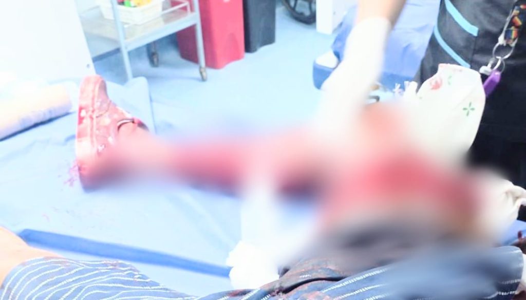 El ciudadano herido fue llevado a una casa de salud.