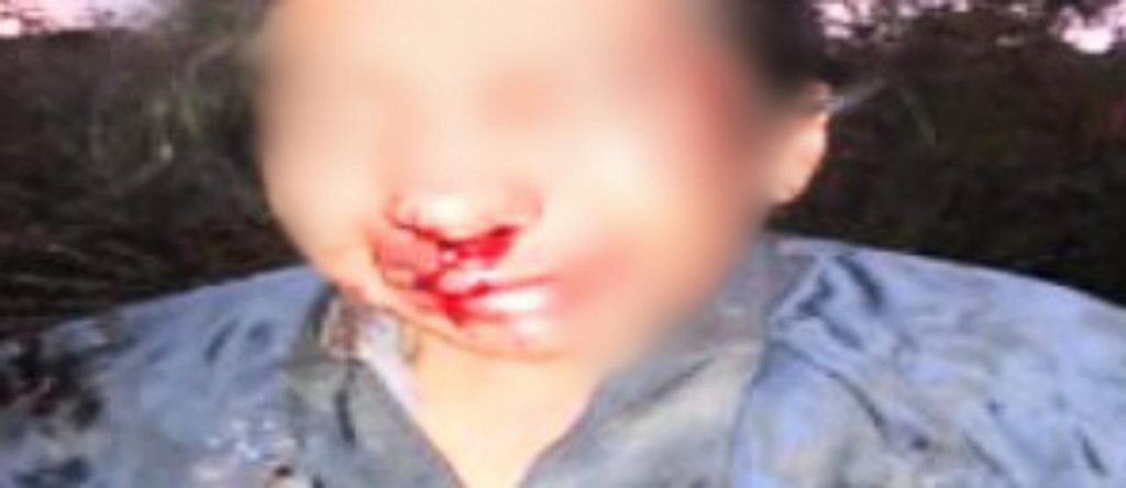 Causante del impasse fue detenido tras la agresión.