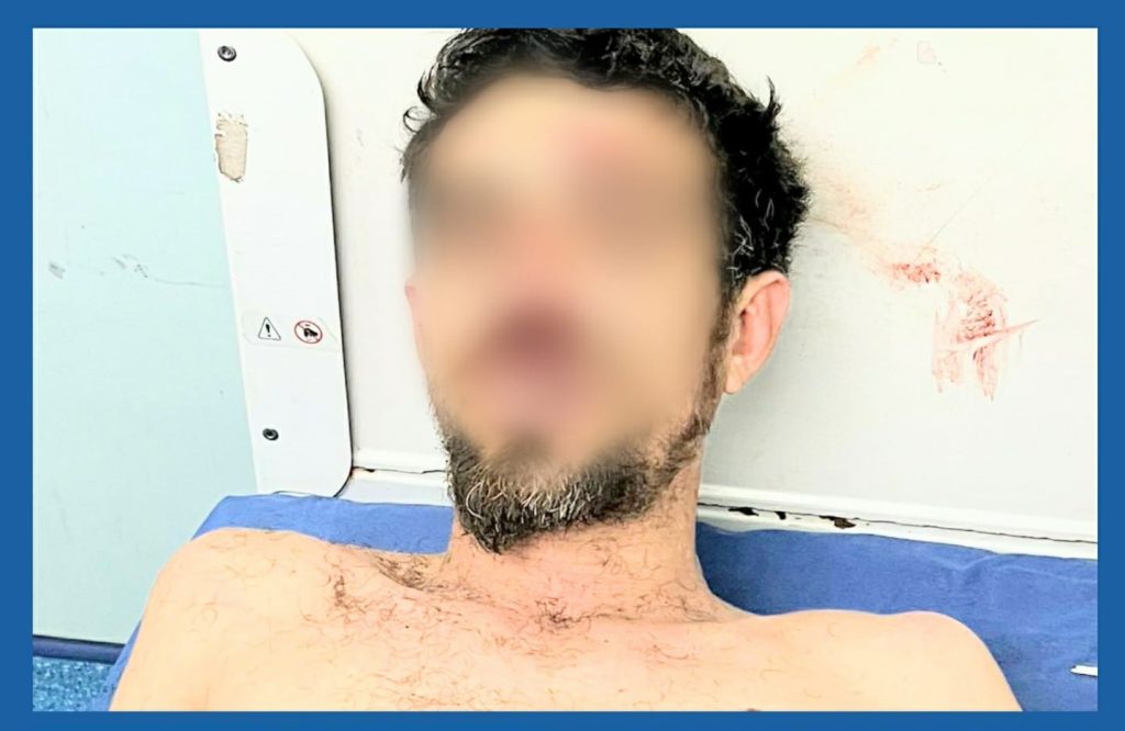 El ciudadano apuntó al policía con el arma de fuego que llevaba.