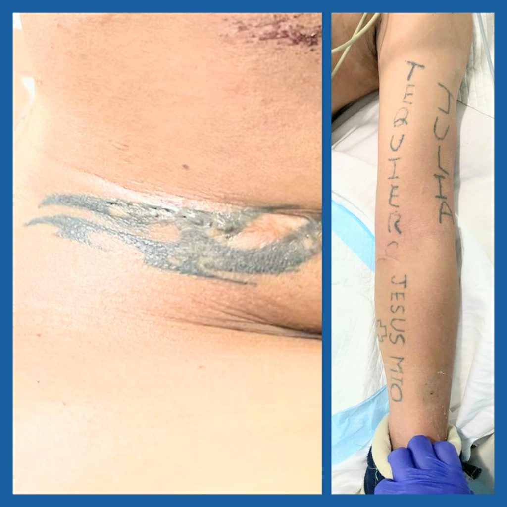 Ellos están en el hospital Isidro Ayora.