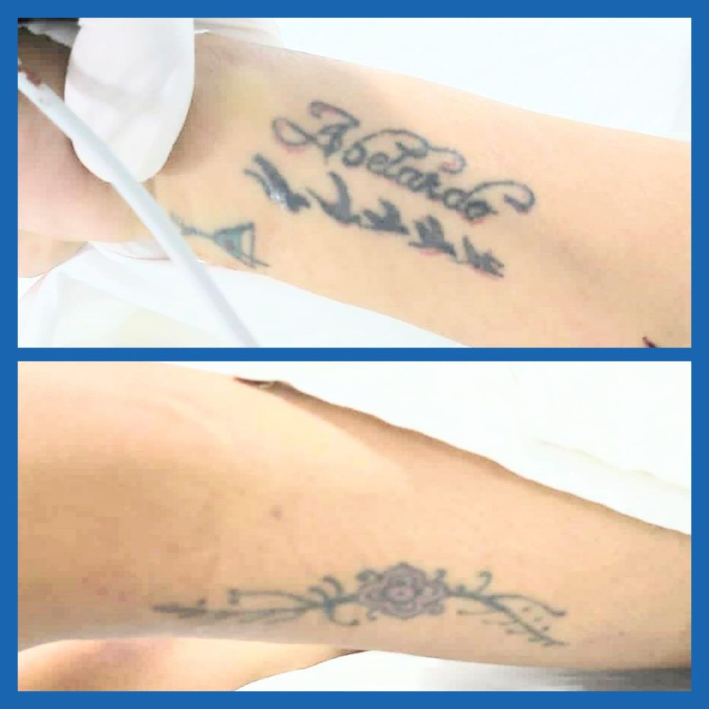 Ella está en la UCI del hospital Isidro Ayora.