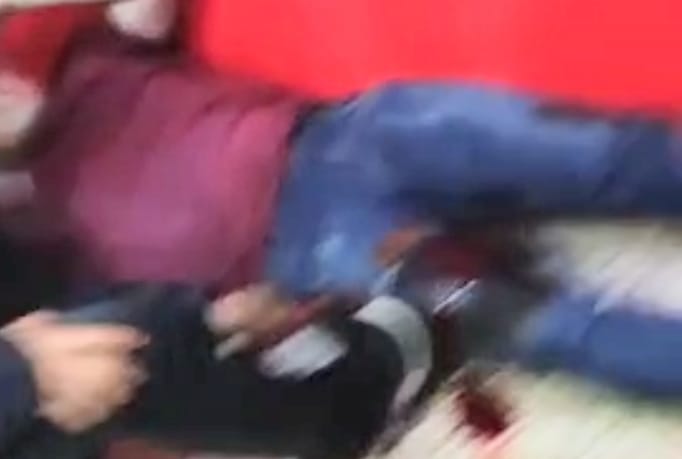 En el tiroteo resultaron heridos los tres ciudadanos.