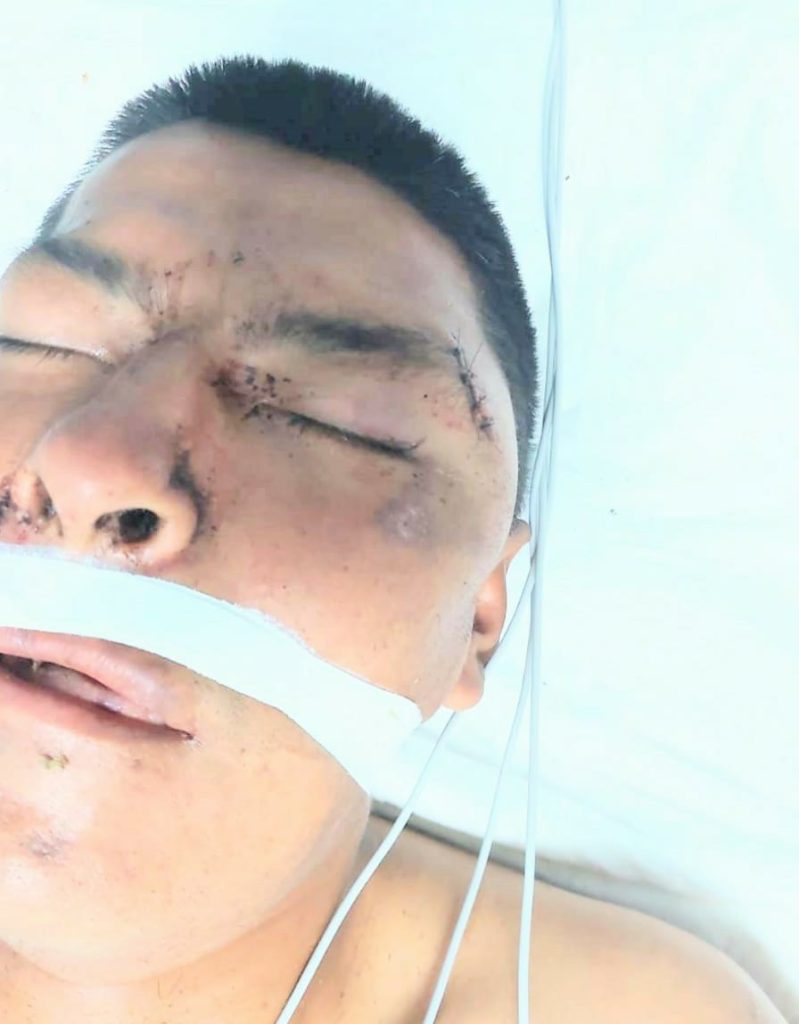 La situación del paciente es crítica.