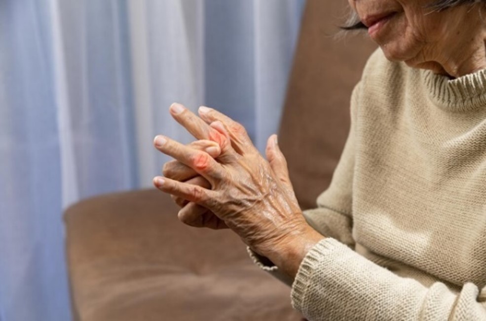 Esta enfermedad prevalece más en los hombres, que en las mujeres.