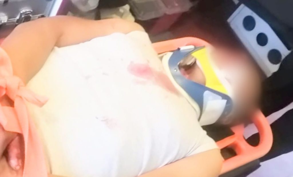 El ciudadano fue llevado al hospital básico José Miguel Rosillo.