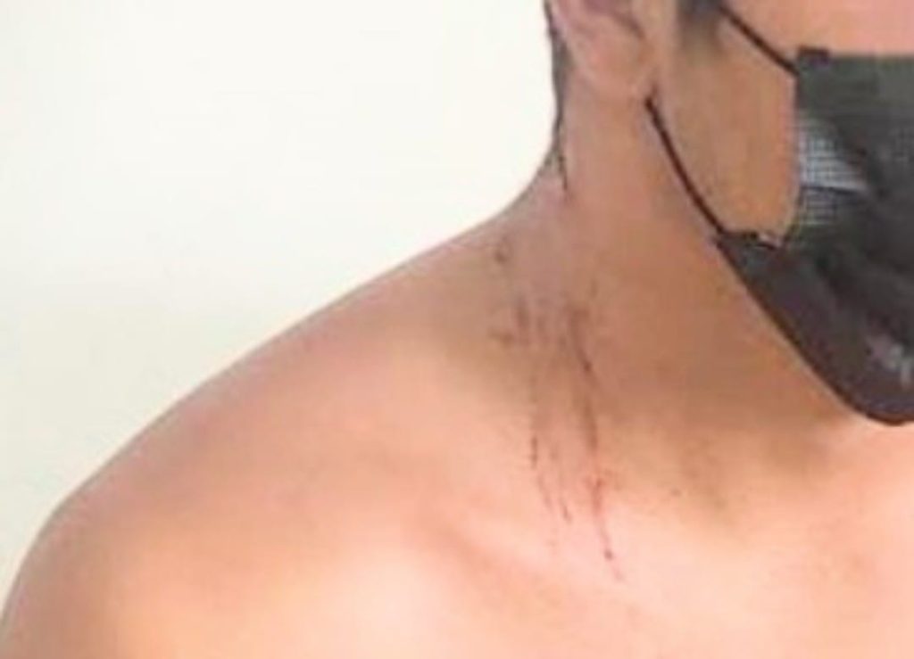 El ciudadano herido tiene 25 años.