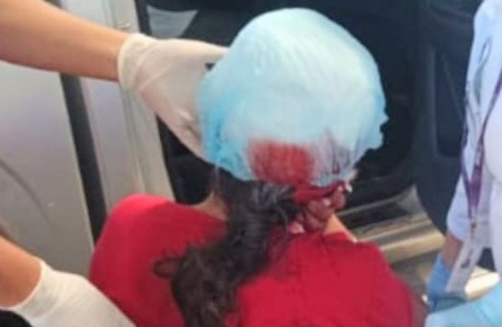 La mujer tiene varias heridas en la cabeza.