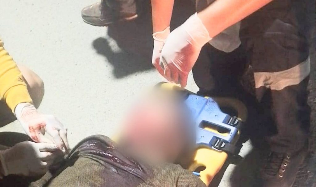 Sobre la calzada quedó el ciudadano colombiano, que tiene cédula de la provincia de Loja.