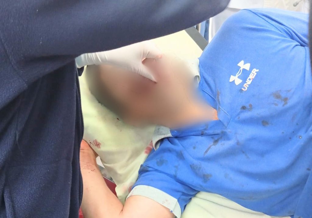 El ciudadano está fuera de peligro y fue llevado a una casa de salud.